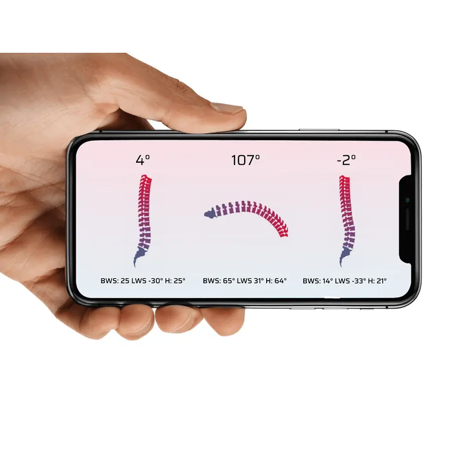 TRICURO go | Appbasert måleapparat Illustrerer formen på ryggraden 
